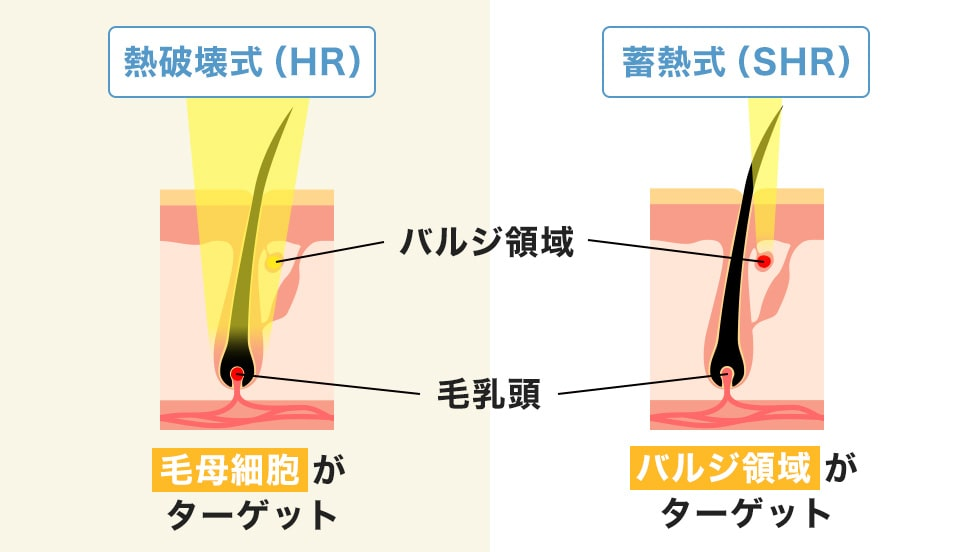 熱破壊式 蓄熱式の画像